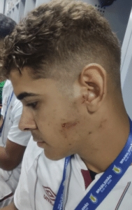 Desfecho da briga do Sub-17 está próximo